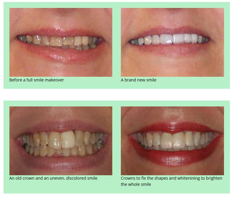 53142 Dental Photos